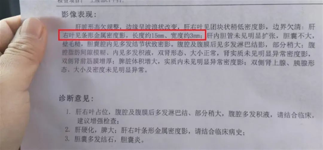 影像报告 受访者提供.png